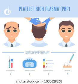 Platelet rich plasma injection procedure. PRP therapy process for men. Male hair loss treatment infographics. Hair regrowth stimulation method. For cosmetology beauty clinic. Vector illustration.