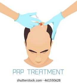 Platelet rich plasma injection procedure for balding men. PRP therapy process. Male hair loss treatment infographics. Vector illustration.