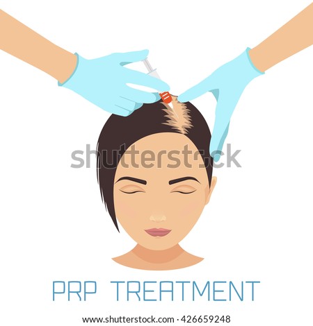 Platelet rich plasma injection procedure. PRP therapy process. Female baldness treatment infographics. Meso therapy and hair growth stimulation. Vector illustration.