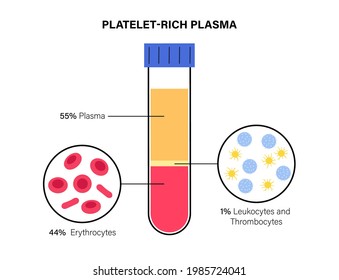 Platelet Rich Plasma Therapy. Blood Composition, Lymphocytes, Thrombocytes And Erythrocytes. Sample In Laboratory. Human Blood Structure And Prp Infographic. Microbiology Test Flat Vector Illustration