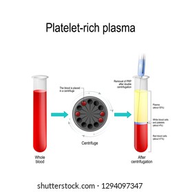 Platelet-rich plasma. Autologous conditioned plasma, is a concentrate of platelet-rich plasma derived from whole blood, centrifuged to remove red blood cells