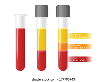 Platelet-Rich Plasma Procedure Stages / Prp / Centrifuge Vector On White