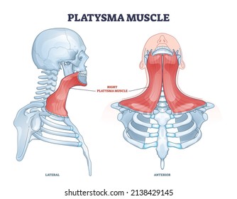 Platysma Muscle As Human Neck And Throat Muscular System Outline Diagram. Labeled Educational Medical Scheme With Anatomical Superficial Muscule That Overlaps Sternocleidomastoid Vector Illustration.