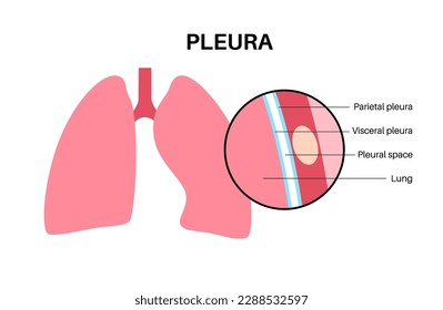 Pleura anatomy concept. Chest cavity medical poster. Membrane tissue in human body. Respiration system scheme. Pulmonary pleurae diagram. Lungs, trachea, bronchi and ribs vector illustration.