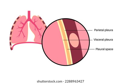 Pleura anatomy concept. Chest cavity medical poster. Membrane tissue in human body. Respiration system scheme. Pulmonary pleurae diagram. Lungs, trachea, bronchi and ribs flat vector illustration.