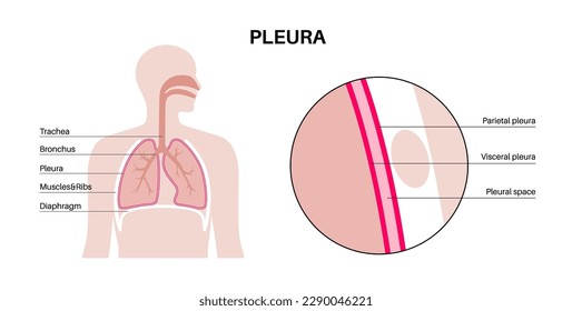 Pleura anatomy concept. Chest cavity medical poster. Membrane tissue in human body. Respiration system scheme. Pulmonary pleurae diagram. Lungs, trachea, bronchi and ribs flat vector illustration.
