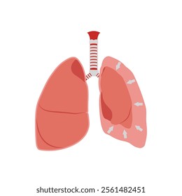 Pleural Effusion, Cardiovascular Disease Illustration Icon