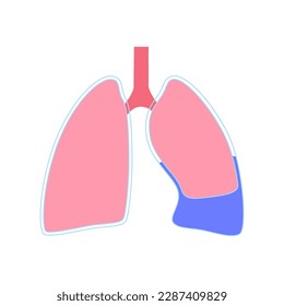 Enfermedad por derrame pleural. Fluido entre las capas de tejido en los pulmones y la cavidad torácica. Es difícil respirar. Órganos internos poco saludables en el cuerpo humano. Ilustración del vector médico del sistema respiratorio