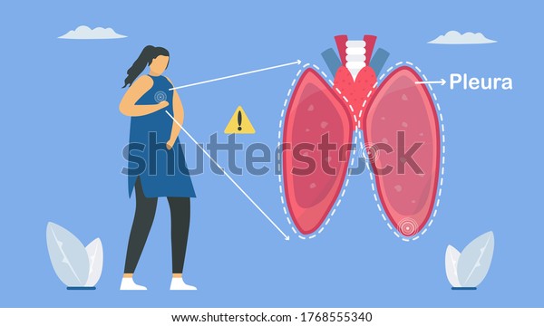 Pleurisy is pleura that separate lungs from\
chest wall. And it becomes inflamed. Pulmonology vector\
illustration about restrictive lung\
disease.