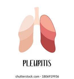 pleurisy lung sounds