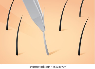 Plucking Gray Hair From Head With Tweezers.