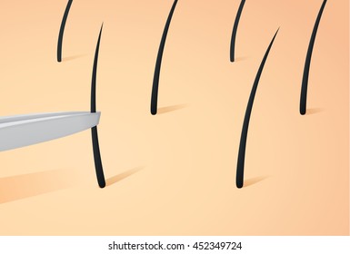 Plucking Hair On Skin With Tweezers.