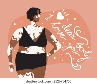 Plus size of woman with vitiligo and text dear body I love you. Flat vector stock illustration. Black skin with vitiligo. Motivating lettering. Concept of body accepting. Vitiligo in African person