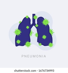 neumonía causada por el coronavirus ilustración vectorial
