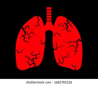 Pneumonia and lung cancer - disease and illness is damaging internal organ in human body. Health problem based on infection, virus, bacteria, tumor and carcinoma. Vector illustration.