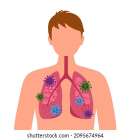 Pneumonia lung disease. Human lungs with virus cells. Infected lung. Covid-19 Coronavirus infection concept vector illustration on white background.