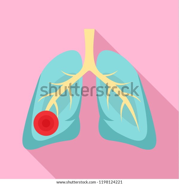 肺炎のアイコン ウェブデザイン用の肺炎の肺のベクター画像アイコンの平らなイラスト のベクター画像素材 ロイヤリティフリー