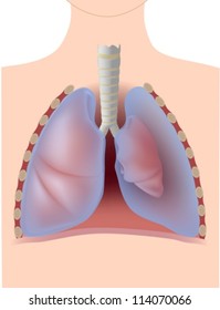 Pneumothorax