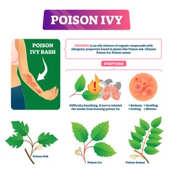 Poison Ivy Vector Illustration. Educational Dangerous Urushoil Plant Scheme With Symptoms And Description. Oak And Chinese Sumac Contact And Skin Problem Causes. Biological Health Hazard Explanation.