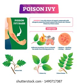 Poison ivy vector illustration. Educational dangerous urushoil plant scheme with symptoms and description. Oak and chinese sumac contact and skin problem causes. Biological health hazard explanation.