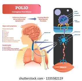 Polio Images, Stock Photos & Vectors | Shutterstock