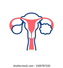 Polycystic ovary syndrome line color icon. Female reproductive system disease. Sign for web page, mobile app, button, logo. Vector isolated element. Editable stroke.