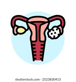 polycystic ovary syndrome woman disease color icon vector. polycystic ovary syndrome woman disease sign. isolated symbol illustration