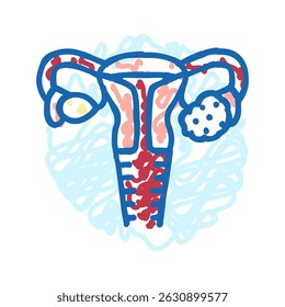 polycystic ovary syndrome woman disease doodle icon sketch vector. polycystic ovary syndrome woman disease sign. isolated symbol illustration