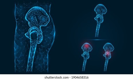 Ilustración poligonal de la vista lateral de los huesos de la cadera y pélvica humanos. Enfermedad, dolor e inflamación de la pelvis y la articulación de la cadera. Modelo de huesos bajos de piernas humanas aislado en fondo azul oscuro