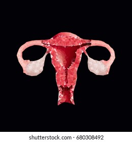 polygonal uterus