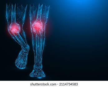 Polygonal vector illustration of human legs, painful and inflamed knees. Sick knees concept. Arthritis of the knee joints.. Medical banner, template or background.