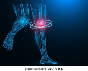 Polygonal vector illustration of human legs, painful and inflamed knee. Sick knee recovery concept. Treatment of knee arthritis. Futuristic medical banner, template or background.