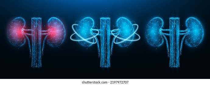 Ilustración vectorial poligonal del riñón inflamado enfermo, riñón sano y recuperación de funciones renales sobre un fondo azul oscuro. Banner, plantilla o fondo médico de orrología o nefrología.