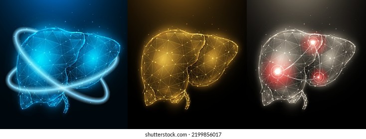 Polygonale Vektorgrafik entzündeter kranker menschlicher Leber, gesunder Leber und Wiederherstellung der Leberfunktion. Innenorgan Low-Poly-Design. Medizinischer Banner, Vorlage oder Hintergrund.
