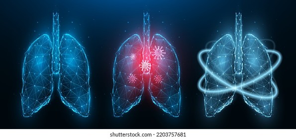 Polygonal Vector Illustration Of Inflamed Diseased Human Lungs, Healthy Lungs And Recovery Of Lung Health. Respiratory System Low Poly Design. Medical Banner, Template Or Background.