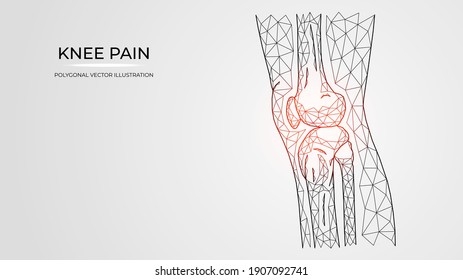 Polygonal vector illustration of pain, inflammation or injury in the knee side view. Human leg bones anatomy. Medical orthopedic diseases templates