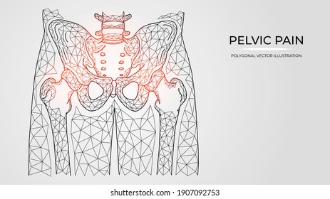 Ilustración vectorial poligonal del dolor, la inflamación o la lesión en la pelvis y la articulación de la cadera. Plantillas para enfermedades ortopédicas médicas