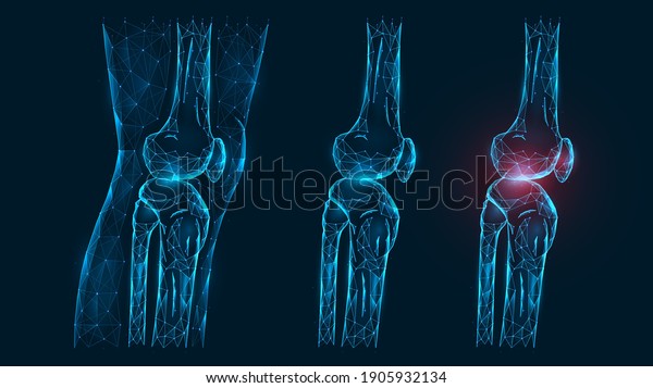 Polygonal Vector Illustration Thigh Knee Joint Stock Vector (Royalty ...