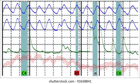 Polygraph Vector