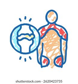 polymyalgia reumatica doodle icon sketch vetor. sinal de polymyalgia reumatica. ilustração de símbolo isolado