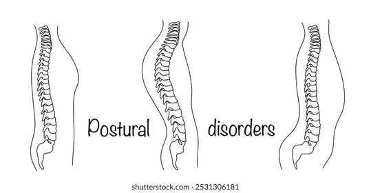 Má postura na forma de um swayback, um round back e um achatado back. Ilustrações de linha simples. Ilustração vetorial.