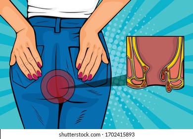 Pop art retro comic style vector illustration of human body with hemorrhoids