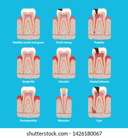 Popular teeth diseases icons in flat design, vector medical illustration. Dental problems infographic elements isolated. Healthy and unhealthy teeth, tooth decay, pulpitis, periodontitis, calculus.