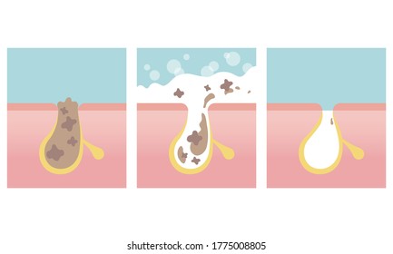 Pore cleansing, facial skin care image. Washing skin with soap. Vector illustration in flat cartoon style.