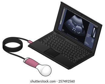 A portable ultrasound scanner wand connected to a laptop computer.