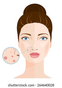 Portrait of beautiful woman. Magnifying glass on face. Trouble and normal skin. 