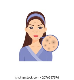 Portrait of Beautiful Young Woman with Blackheads on Face. Diagnosis and Analysis of Teenage Skin. Zoom. Flat Color Cartoon Style. White background. Illustration for Cosmetology, Beauty Design. Vector
