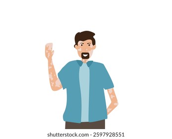 Portrait of a happy young man with vitiligo. Close up of man with skin disorder. male character with vitiligo. Vector illustration on isolated background.