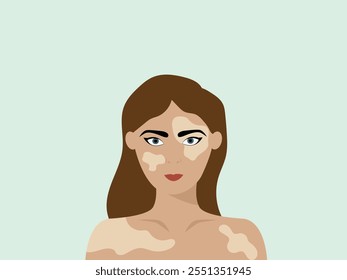 Retrato de uma jovem feliz com vitiligo. Close de mulher com distúrbio de pele. Personagem feminino com vitiligo. Ilustração vetorial em plano de fundo isolado.