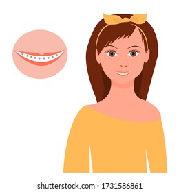 Portrait of pretty woman smiling with braces isolated on white background stock vector illustration. Graphic design, stomatology, dental, orthodontic concept, healthcare